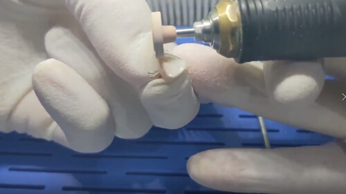 Polishing 3D printed (AON Inni-Cera) zirconia walkthrough